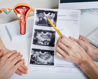 Ginekologia onkologiczna w Kaliszu