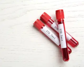 diagnostyka zakażeń ginekologicznych STD